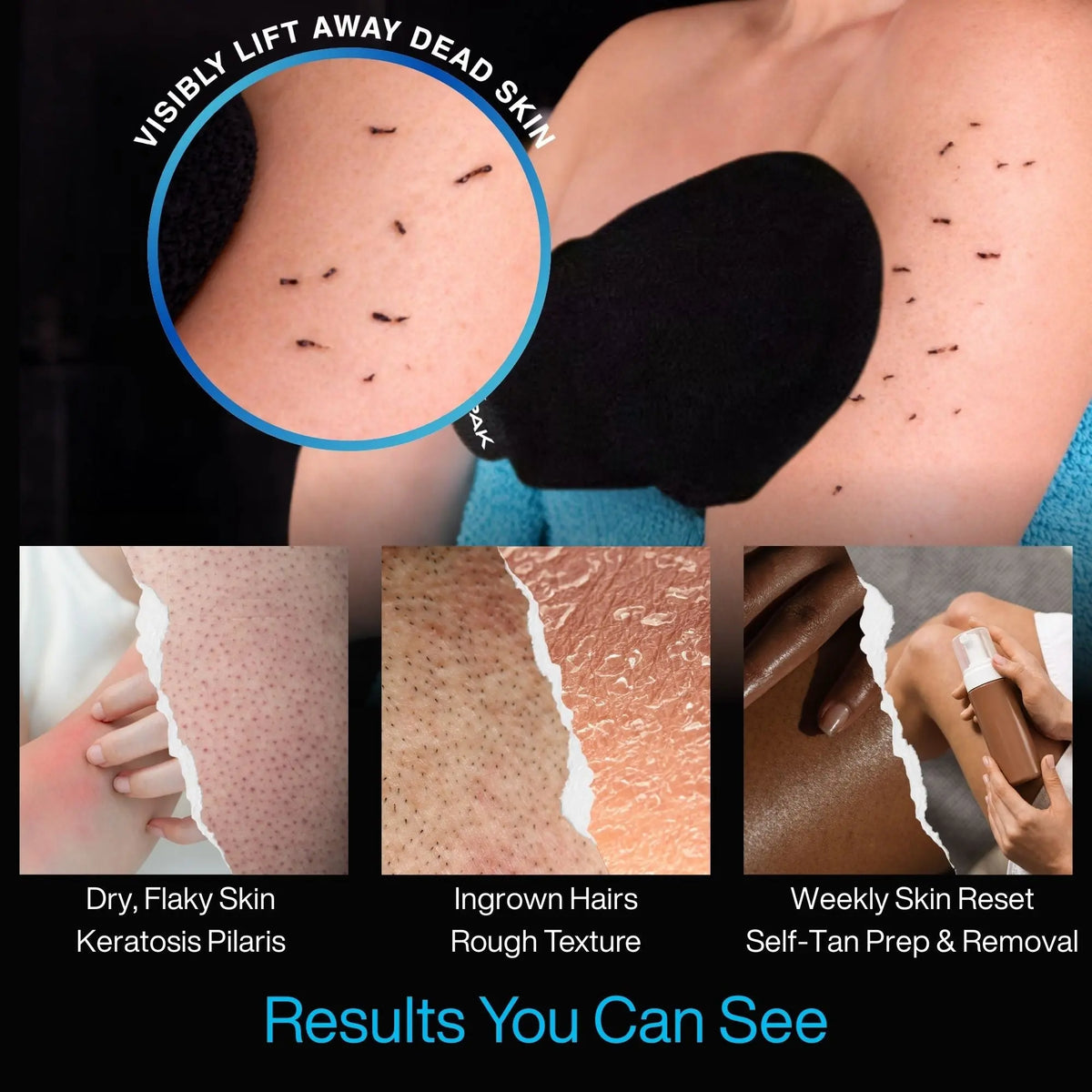 Product being used on skin with close-up of effects, labeled 'Visibly lift away dead skin'.